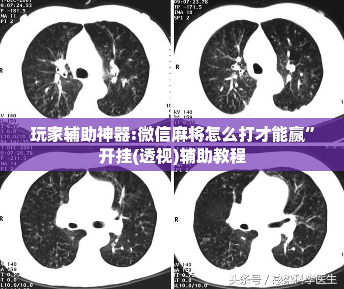 玩家辅助神器:微信麻将怎么打才能赢	”开挂(透视)辅助教程