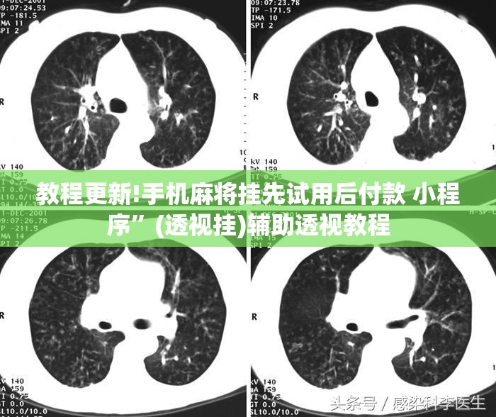 教程更新!手机麻将挂先试用后付款 小程序”(透视挂)辅助透视教程