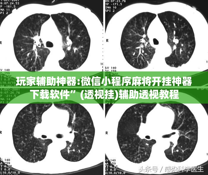 玩家辅助神器:微信小程序麻将开挂神器下载软件	”(透视挂)辅助透视教程