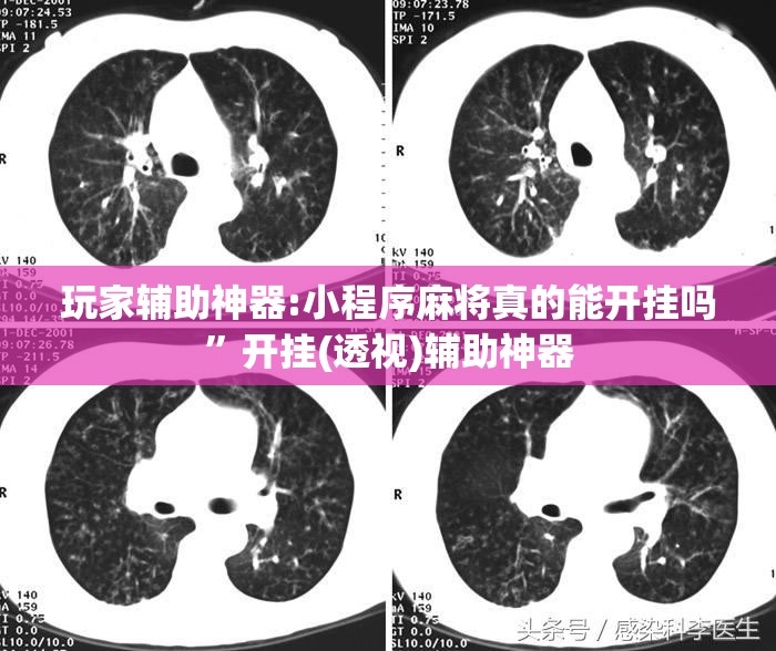 玩家辅助神器:小程序麻将真的能开挂吗”开挂(透视)辅助神器