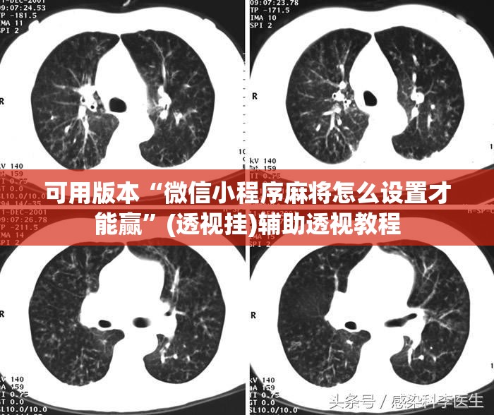 可用版本“微信小程序麻将怎么设置才能赢”(透视挂)辅助透视教程