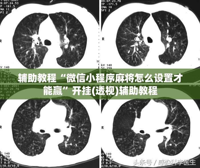 辅助教程“微信小程序麻将怎么设置才能赢”开挂(透视)辅助教程