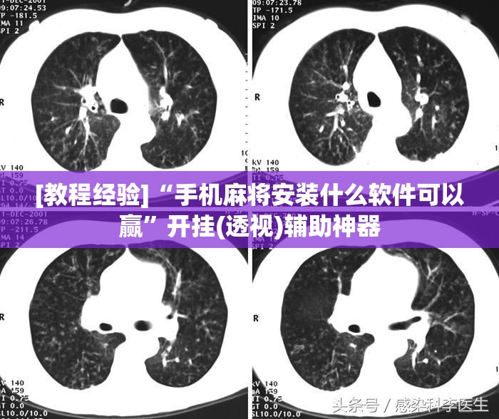 [教程经验]“手机麻将安装什么软件可以赢	”开挂(透视)辅助神器
